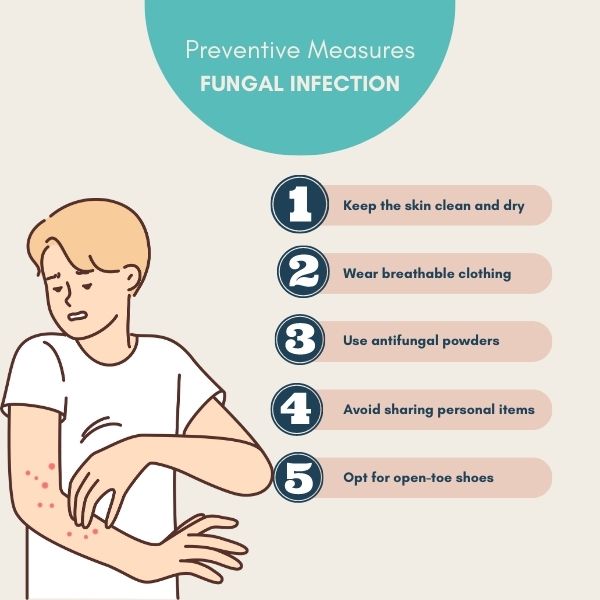 Everything You Need to Know About Fungal Skin Infections